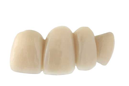 Teeth Bridges